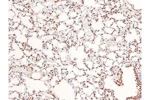 Image no. 3 for anti-Apoptotic Chromatin Condensation Inducer 1 (ACIN1) (pSer1180) antibody (ABIN6271640)