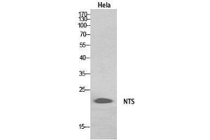 Image no. 2 for anti-Neurotensin (NTS) (Internal Region) antibody (ABIN3187998)