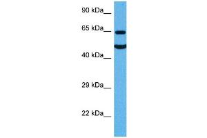 Image no. 5 for anti-Solute Carrier Family 1 (Glial High Affinity Glutamate Transporter), Member 2 (SLC1A2) (N-Term) antibody (ABIN2778148)