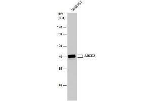 WB Image ABCD2 antibody detects ABCD2 protein by western blot analysis.