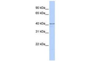 Image no. 1 for anti-Heterogeneous Nuclear Ribonucleoprotein D-Like (HNRPDL) (C-Term) antibody (ABIN6740681)