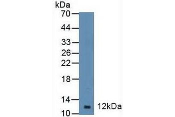Diazepam Binding Inhibitor Antikörper  (AA 1-104)