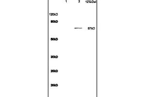 Image no. 1 for anti-Interleukin 23 Receptor (IL23R) (AA 401-550) antibody (ABIN686857)