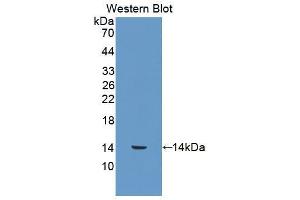 Image no. 1 for anti-S100 Calcium Binding Protein A12 (S100A12) (AA 2-92) antibody (ABIN2910224)