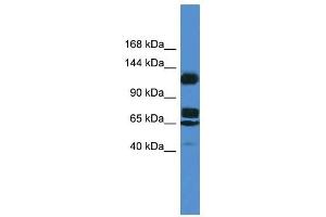 Image no. 1 for anti-Suppression of Tumorigenicity 5 (ST5) (Middle Region) antibody (ABIN926479)
