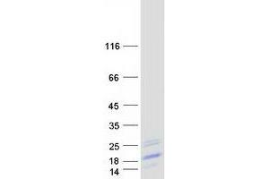 Image no. 1 for Basic Leucine Zipper ATF-like Transcription Factor (BATF) protein (Myc-DYKDDDDK Tag) (ABIN2715161)