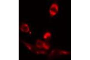 Image no. 2 for anti-Regulatory Factor X 3 (RFX3) antibody (ABIN6264716)