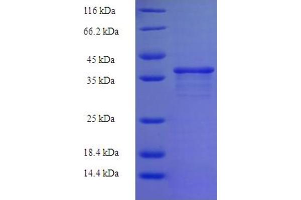 Zinc Finger Protein 26 (ZNF26) (AA 335-533), (partial) protein (His-SUMO Tag)