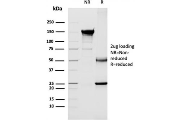 CD40 Ligand 抗体  (AA 108-261)