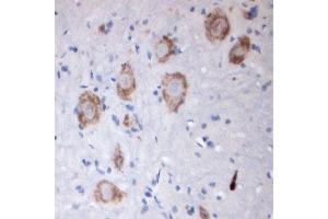 Image no. 1 for anti-Solute Carrier Family 18 (Vesicular Acetylcholine), Member 3 (SLC18A3) (Internal Region) antibody (ABIN571639)