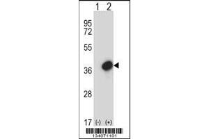 Image no. 1 for anti-General Transcription Factor IIE, Polypeptide 2 (GTF2E2) (AA 240-269), (C-Term) antibody (ABIN5533296)