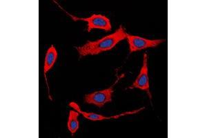 Image no. 1 for anti-Collagen, Type I, alpha 2 (COL1A2) (N-Term) antibody (ABIN2707434)