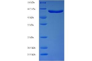 Image no. 1 for Syntaphilin (SNPH) (AA 1-424), (partial) protein (His-SUMO Tag) (ABIN5710390)