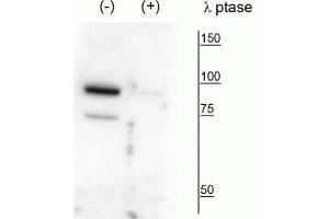 Image no. 1 for anti-Pantothenate Kinase 4 (PANK4) (pThr63) antibody (ABIN6254045)