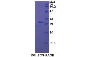 Image no. 3 for Lipopolysaccharide Binding Protein (LBP) ELISA Kit (ABIN6720569)
