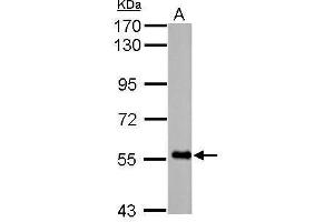 Image no. 1 for anti-F-Box Protein 7 (FBXO7) (Center) antibody (ABIN2854370)