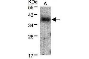 WB Image Sample(30 μg of whole cell lysate) A:A431, 12% SDS PAGE antibody diluted at 1:1500