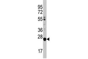 Image no. 3 for anti-Lin-28 Homolog B (LIN28B) (AA 218-250) antibody (ABIN3031629)