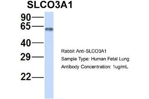Image no. 2 for anti-Solute Carrier Organic Anion Transporter Family, Member 3A1 (SLCO3A1) (Middle Region) antibody (ABIN2781632)