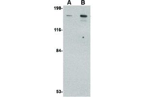 Image no. 3 for anti-CAP-GLY Domain Containing Linker Protein 1 (CLIP1) (C-Term) antibody (ABIN6656133)