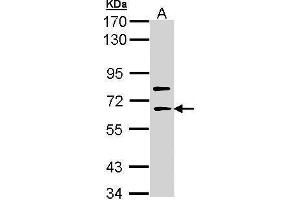Image no. 1 for anti-SHC (Src Homology 2 Domain Containing) Family, Member 4 (SHC4) (Center) antibody (ABIN2856800)