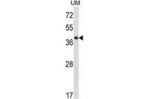 Image no. 2 for anti-Speckle-Type POZ Protein-Like (SPOPL) (AA 228-357), (Middle Region) antibody (ABIN954939)