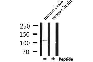 Image no. 2 for anti-Interferon Induced with Helicase C Domain 1 (IFIH1) antibody (ABIN6258879)