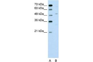 Image no. 1 for anti-Zinc Finger Protein 19 (ZNF19) (N-Term) antibody (ABIN2775355)
