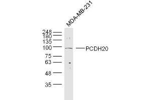 Lane 1: MDA-MB-231 cell lysates probed with 	PCDH20 Polyclonal Antibody, Unconjugated  at 1:300 overnight at 4˚C.