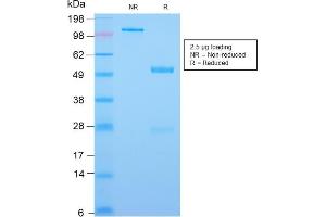 Image no. 1 for anti-Caudal Type Homeobox 2 (CDX2) (AA 150-249) antibody (ABIN6939060)