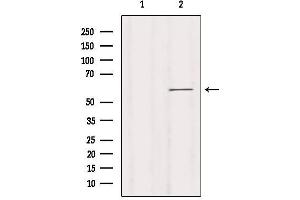 Image no. 2 for anti-Potassium Intermediate/small Conductance Calcium-Activated Channel, Subfamily N, Member 1 (KCNN1) (Internal Region) antibody (ABIN6258248)