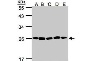 Image no. 2 for anti-Proteasome Subunit alpha 2 (PSMA2) (Center) antibody (ABIN2855667)