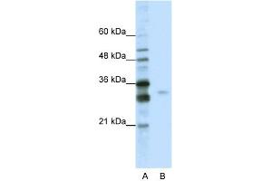 Image no. 1 for anti-serine/arginine-Rich Splicing Factor 1 (SRSF1) (C-Term) antibody (ABIN2779013)
