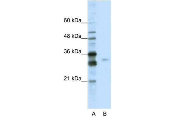 anti-serine/arginine-Rich Splicing Factor 1 (SRSF1) (C-Term) antibody