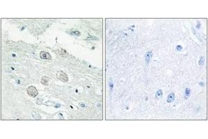 Image no. 1 for anti-Janus Kinase 1 (JAK1) (AA 91-140) antibody (ABIN1533664)
