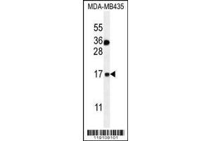 Image no. 1 for anti-S100 Calcium Binding Protein A1 (S100A1) (AA 45-75), (C-Term) antibody (ABIN655724)