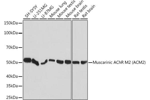 Muscarinic Acetylcholine Receptor M2 antibody