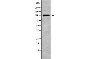 Image no. 1 for anti-phosphodiesterase 5A, cGMP-Specific (PDE5A) (C-Term) antibody (ABIN6264094)