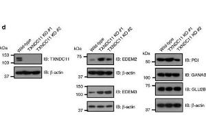 Image no. 5 for anti-Glucosidase, Alpha, Neutral AB (GANAB) (N-Term) antibody (ABIN2855336)