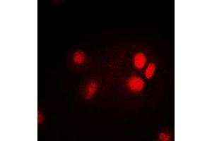 Image no. 1 for anti-Thymopoietin (TMPO) (full length) antibody (ABIN6006182)
