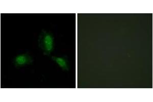Image no. 3 for anti-Insulin Receptor Substrate 1 (IRS1) (AA 279-328) antibody (ABIN1532908)