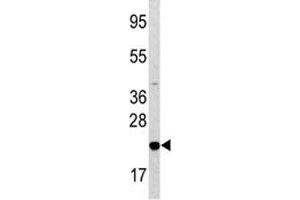 Image no. 2 for anti-BCL2-Associated Agonist of Cell Death (BAD) (AA 53-81) antibody (ABIN3030115)