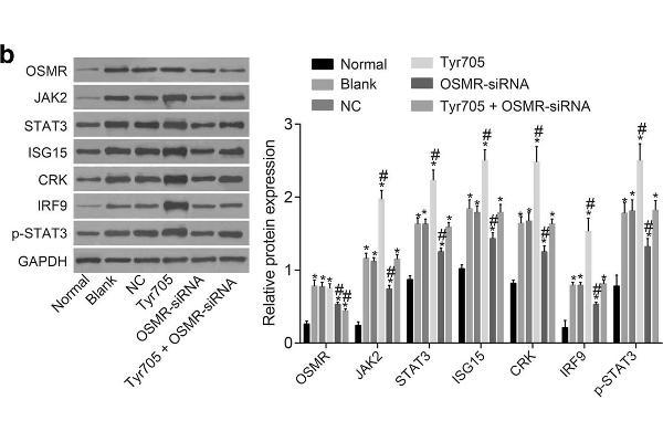 anti-Oncostatin M Receptor (OSMR) (AA 1-740) antibody