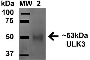 Image no. 1 for anti-Unc-51-Like Kinase 3 (ULK3) (AA 166-177) antibody (FITC) (ABIN5066185)