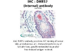 Image no. 1 for anti-Dehydrogenase/reductase (SDR Family) Member 7 (DHRS7) (Internal Region) antibody (ABIN1733631)