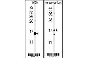 Image no. 1 for anti-Interleukin 4 (IL4) (AA 122-150), (AA 122-151), (C-Term) antibody (ABIN651434)