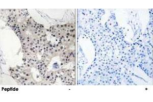 Image no. 1 for anti-B Melanoma Antigen Family, Member 4 (BAGE4) (Internal Region) antibody (ABIN5648926)