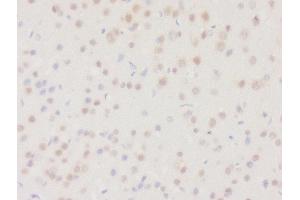 Image no. 1 for anti-Dehydrogenase/reductase (SDR Family) Member 2 (DHRS2) (AA 61-160) antibody (ABIN2559682)