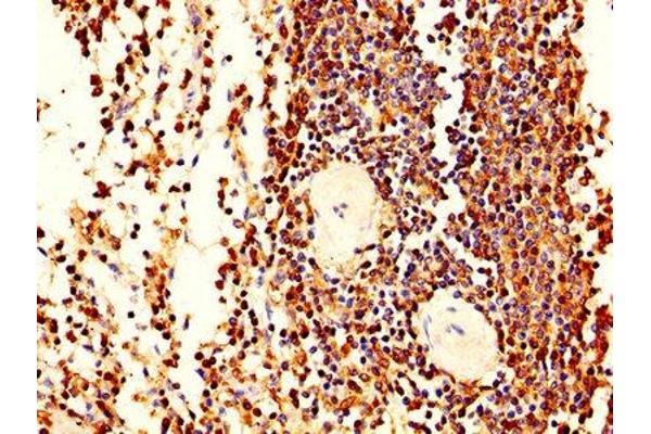 LCP1 antibody  (AA 2-627)
