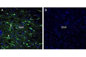 Expression of GPR52 in rat substantia nigra - Immunohistochemical staining of perfusion-fixed frozen rat brain sections with Anti-GPR52 Antibody (ABIN7043161, ABIN7044453 and ABIN7044454), (1:300), followed by goat anti-rabbit-AlexaFluor-488.